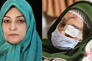 هولناک ترین سرنوشت یک زن ایرانی / اشرف سادات تکه تکه شد ولی زنده ماند + (تصاویر ۱۶+)