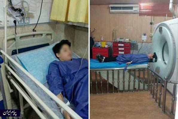 دانش‌آموز قزوینی، به دلیل ضرب و شتم مآقای مدیر راهی بیمارستان شد