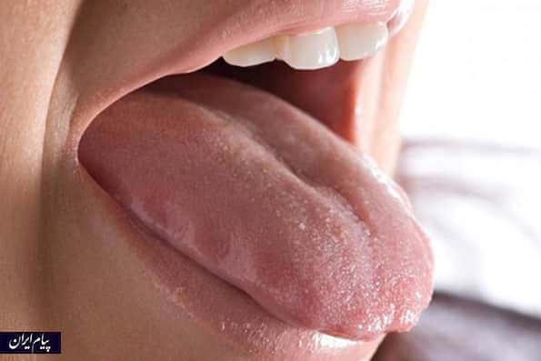  نشانه های سرطان روی زبان را می شناسید؟