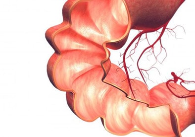 التهاب روده خطر ابتلا به سرطان پروستات را ۵ برابر می‌کند