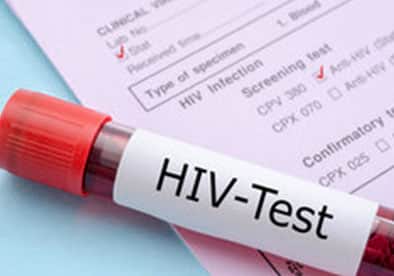 علائم HIV که خانم‌ها باید بدانند