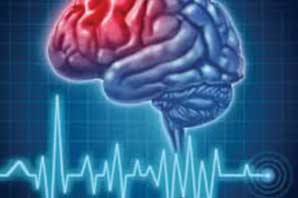 افزایش فوتی ها براثر سکته مغزی در دوران کرونا