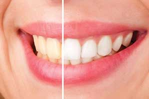 مصرف کدام خوراکی ها دندان‌ها را زرد می کند؟