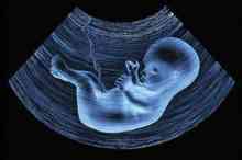 لغو "اجبار" در غربالگری دوران بارداری" خطرناک برای سلامت جامعه